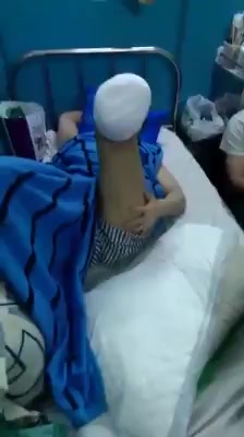 lost leg boy