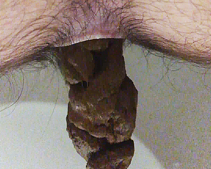 SHITTING IN THE TOILET #4