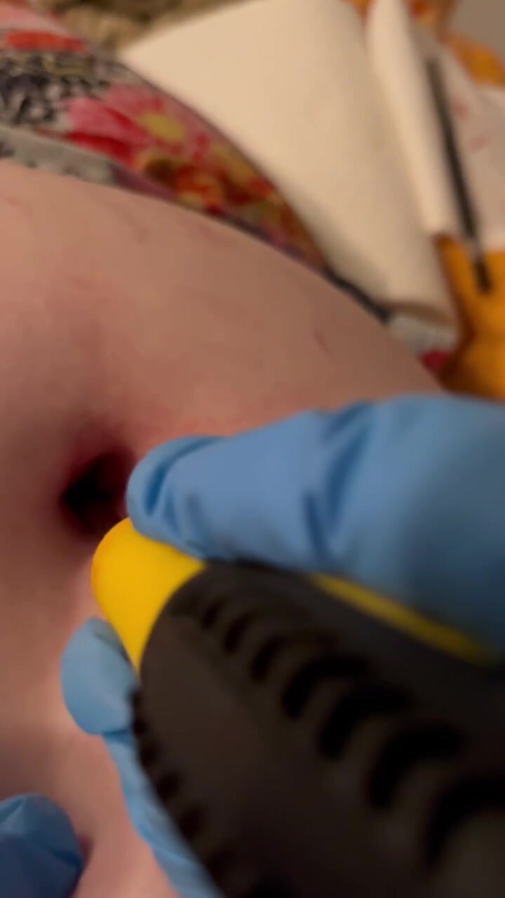 Navel stab with screwdriver - video 2