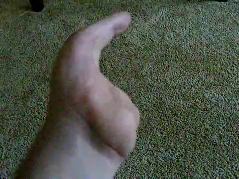 Fingers amputated because of explosion