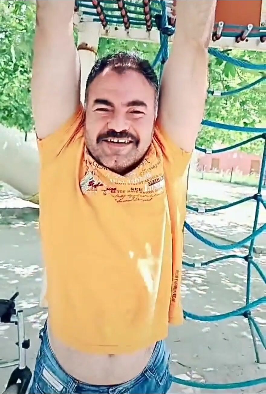 DAK amputee man