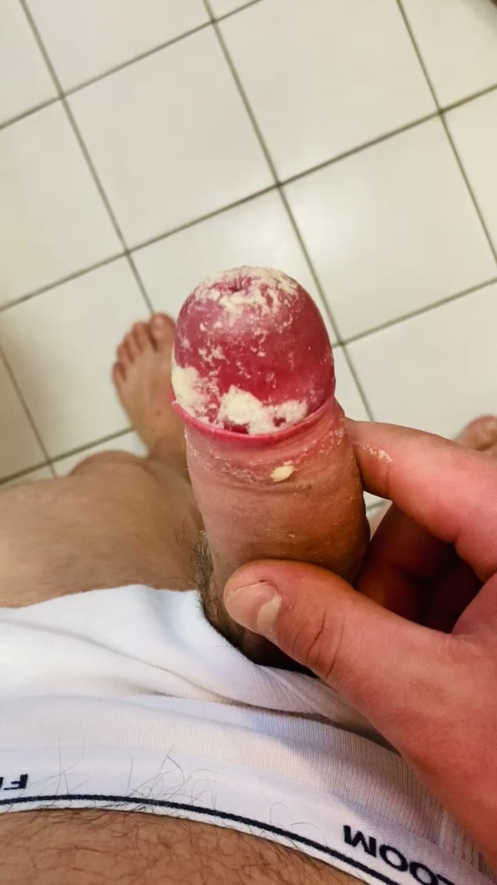 Smegma Twink - Extremely dirty