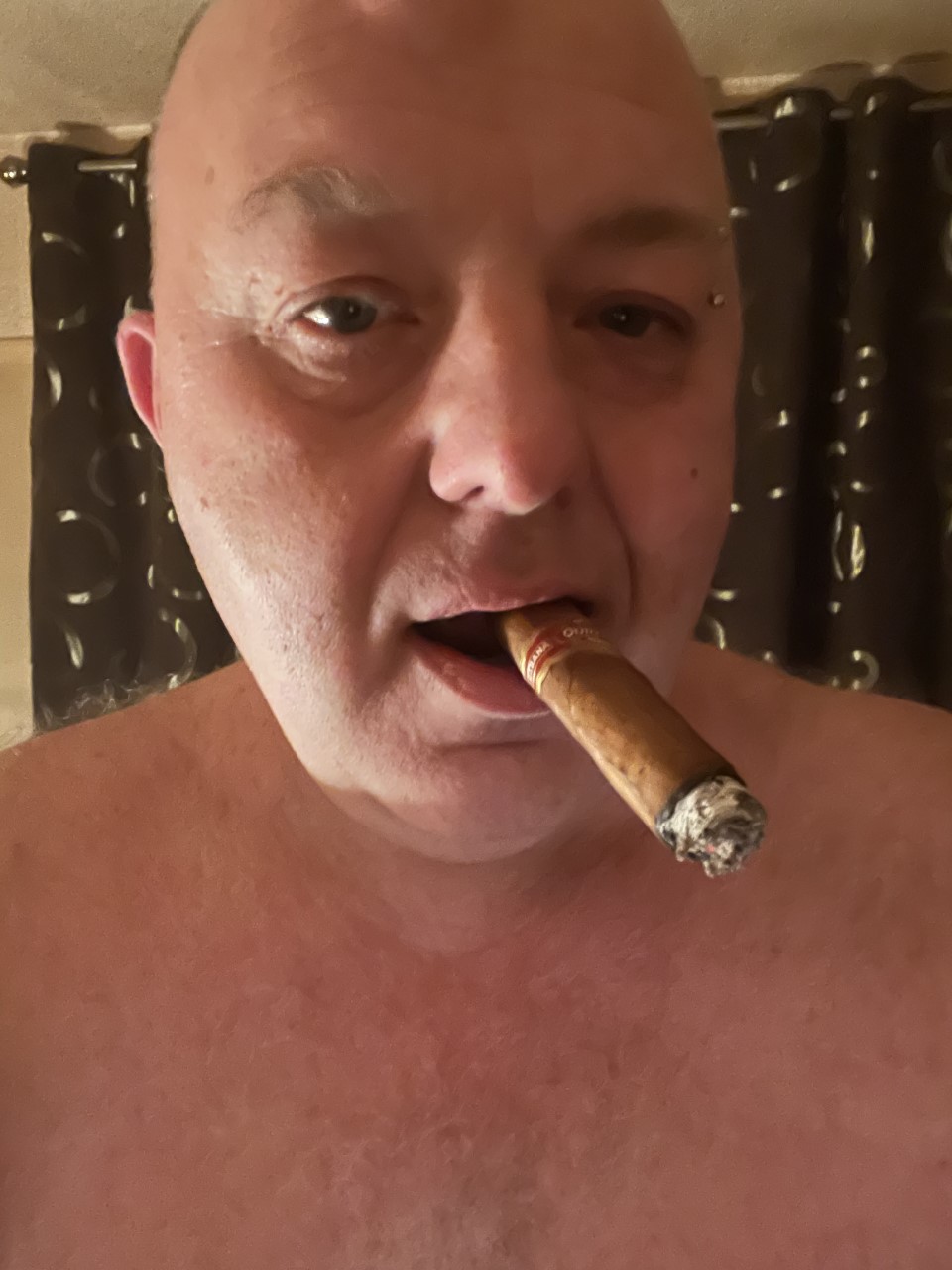 Post Surgery Cigar