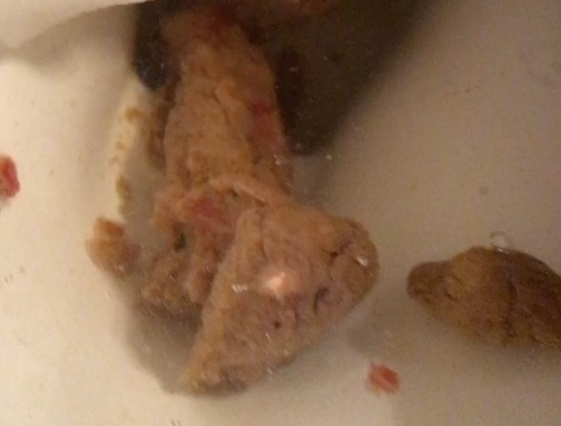 7 Plops of Shit in the Toilet (and PIss)