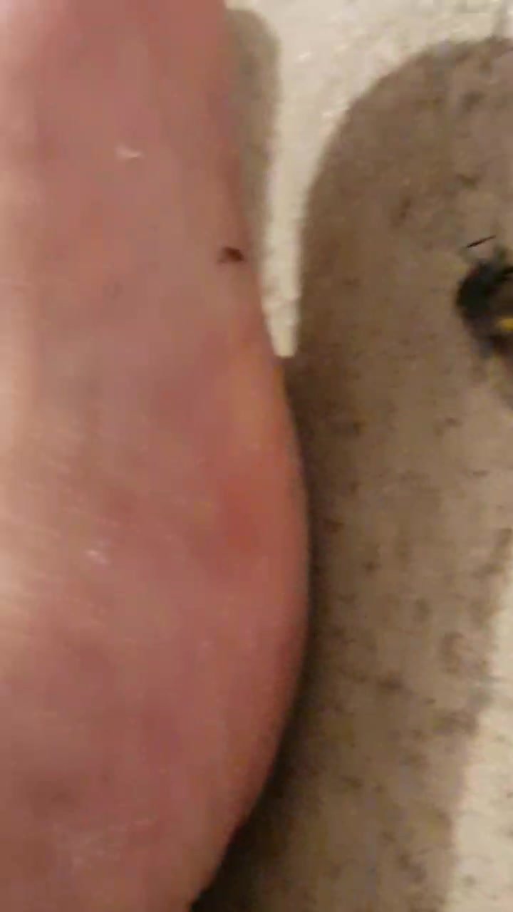 My toe flattens a dead fly