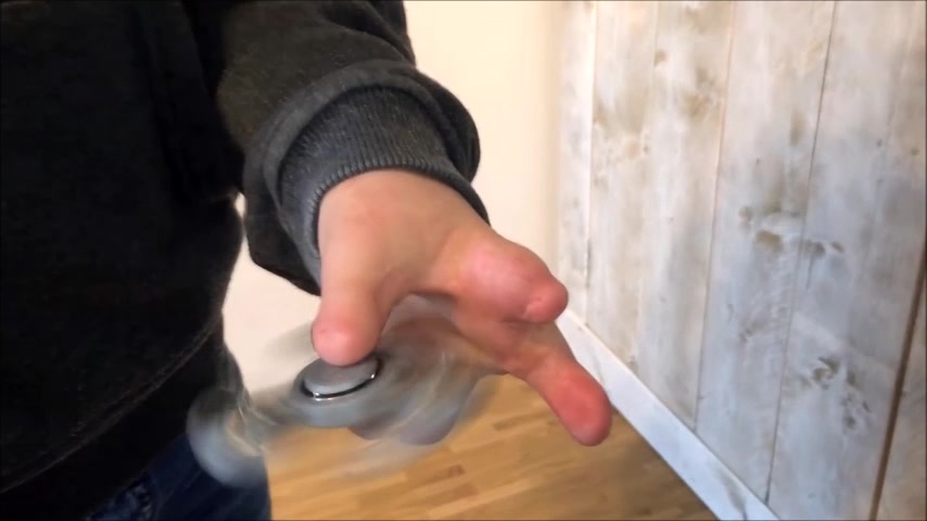 congenital hand - video 5