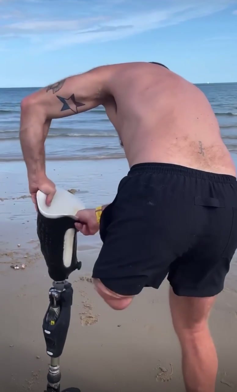 Sexy amputee - video 2
