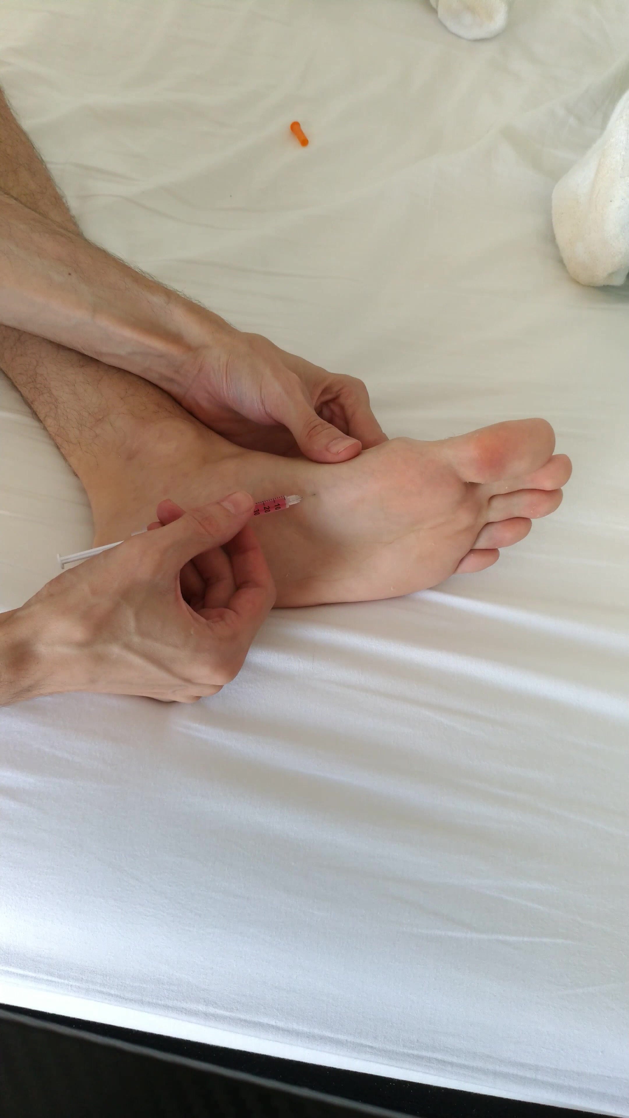 Twink bare foot B12 injection 2/2