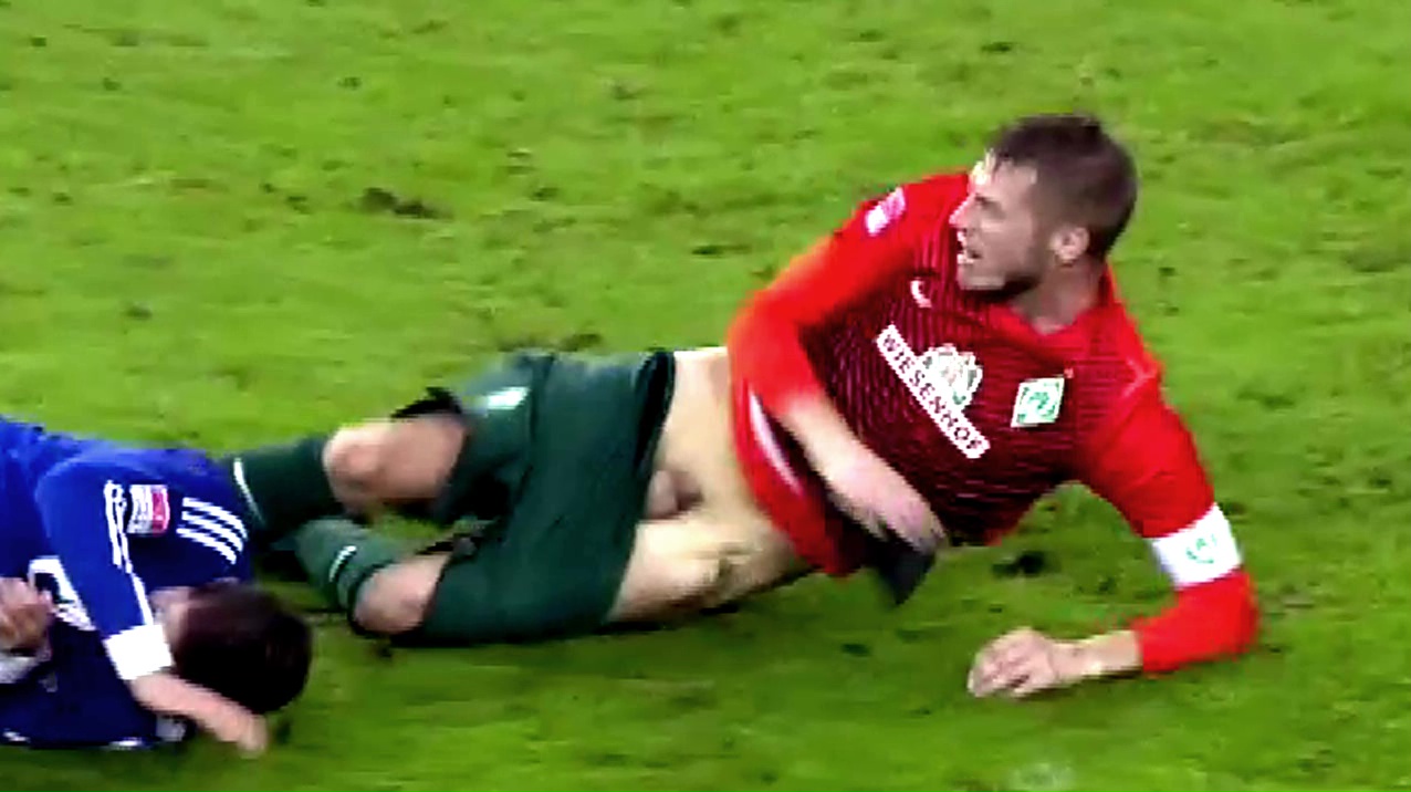 German football player accidental nudity
