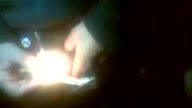 burning pubes , internet find, low quality old video