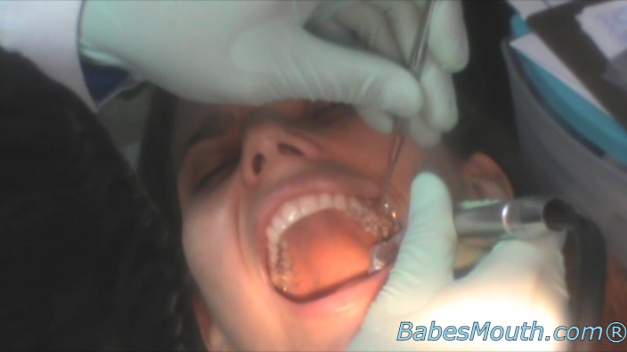 Babesmouth Mimi Drilled