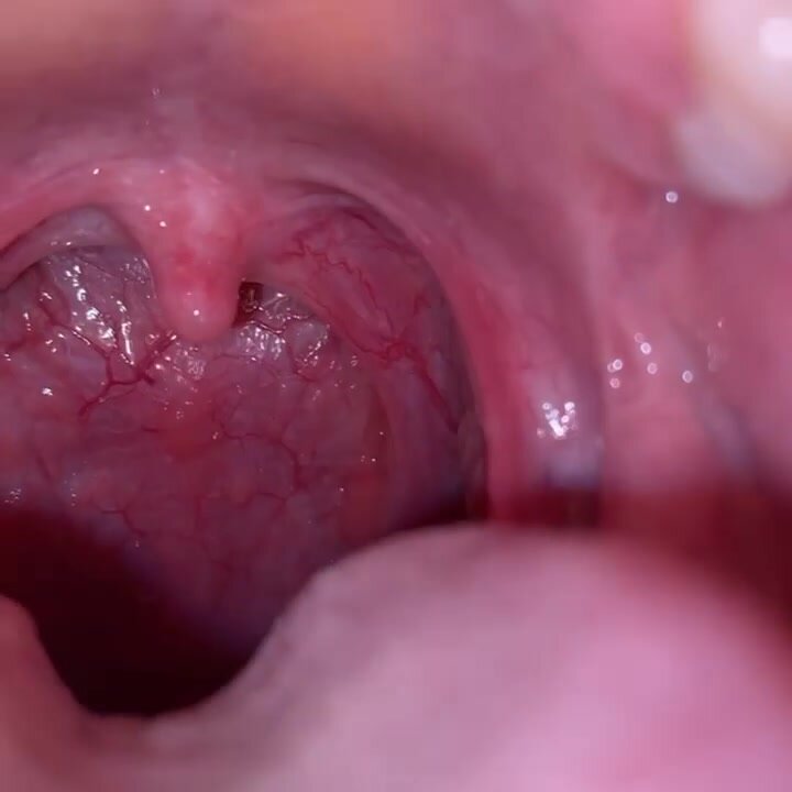 Mouth tour tongue - video 2