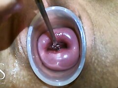 MS Masturbating Her Cervix with a Spoon