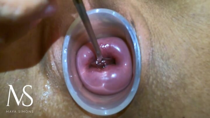 MS Masturbating Her Cervix with a Spoon