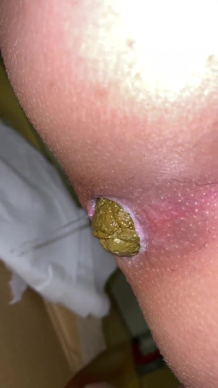 Anal Close-up scat video 1