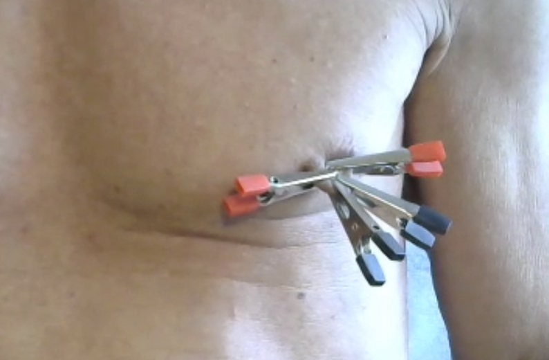 Alligator clips used on nipples