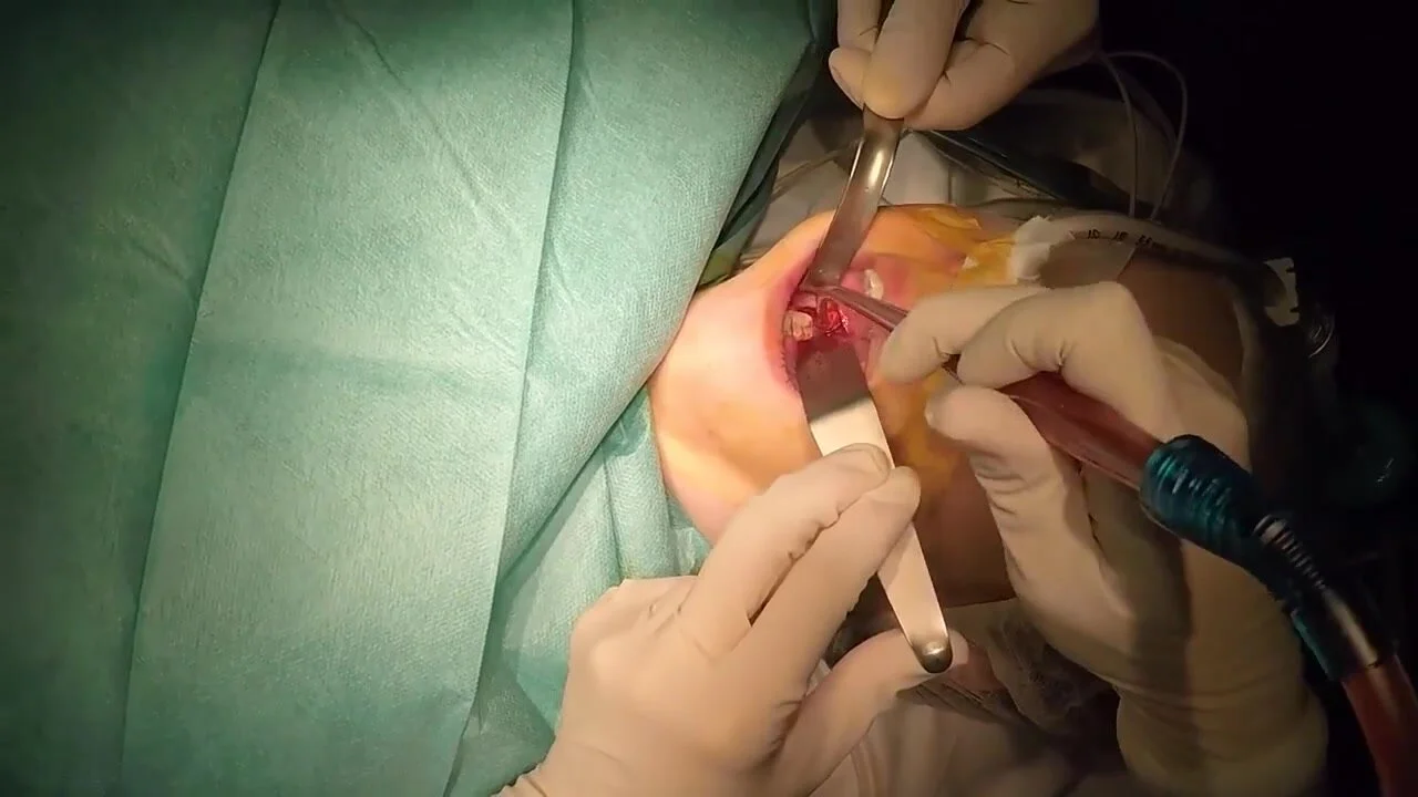 Surgery Fetish Porn - Dentist videos fetish: Dental Surgery - ThisVid.com