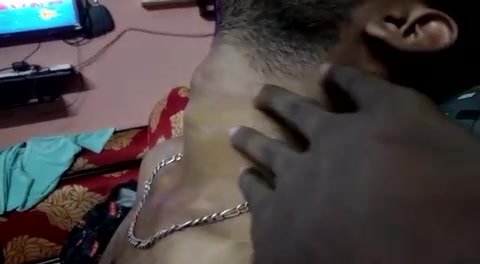 Adam’s apple - video 201