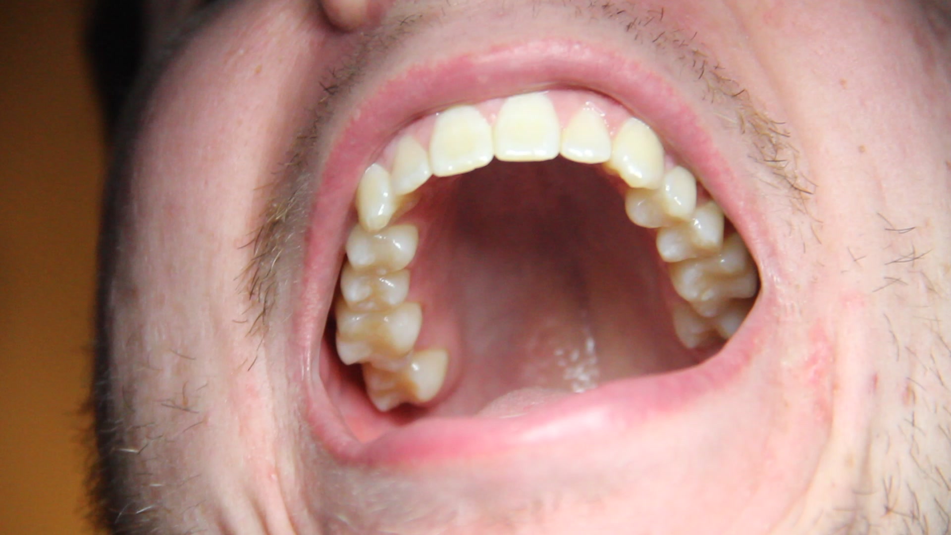 Inspecting my big white chompers