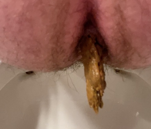 Poop From My Hole