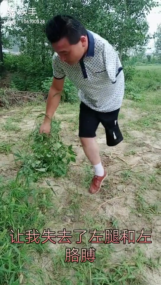 Amputee OOE4