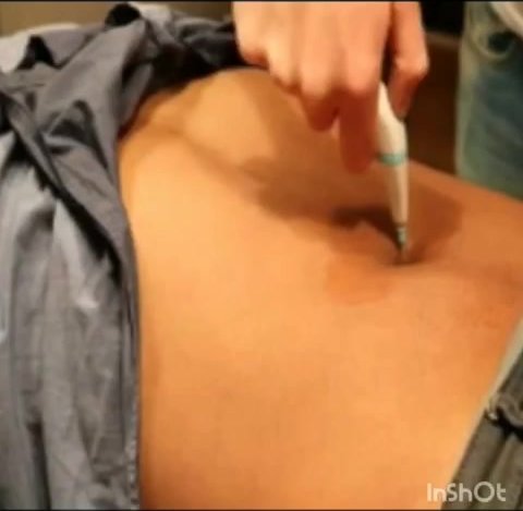 Bellybutton Tickled By A Flosser