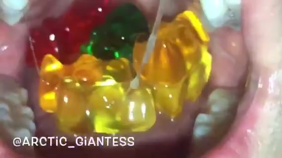 Gummy swallowing - video 3