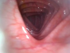 Endoscopy deep inside my girlfriend's colon