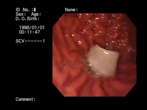 Digestion of prosciutto in the stomach
