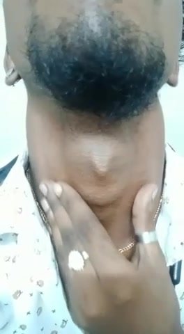 Adams apple - video 30
