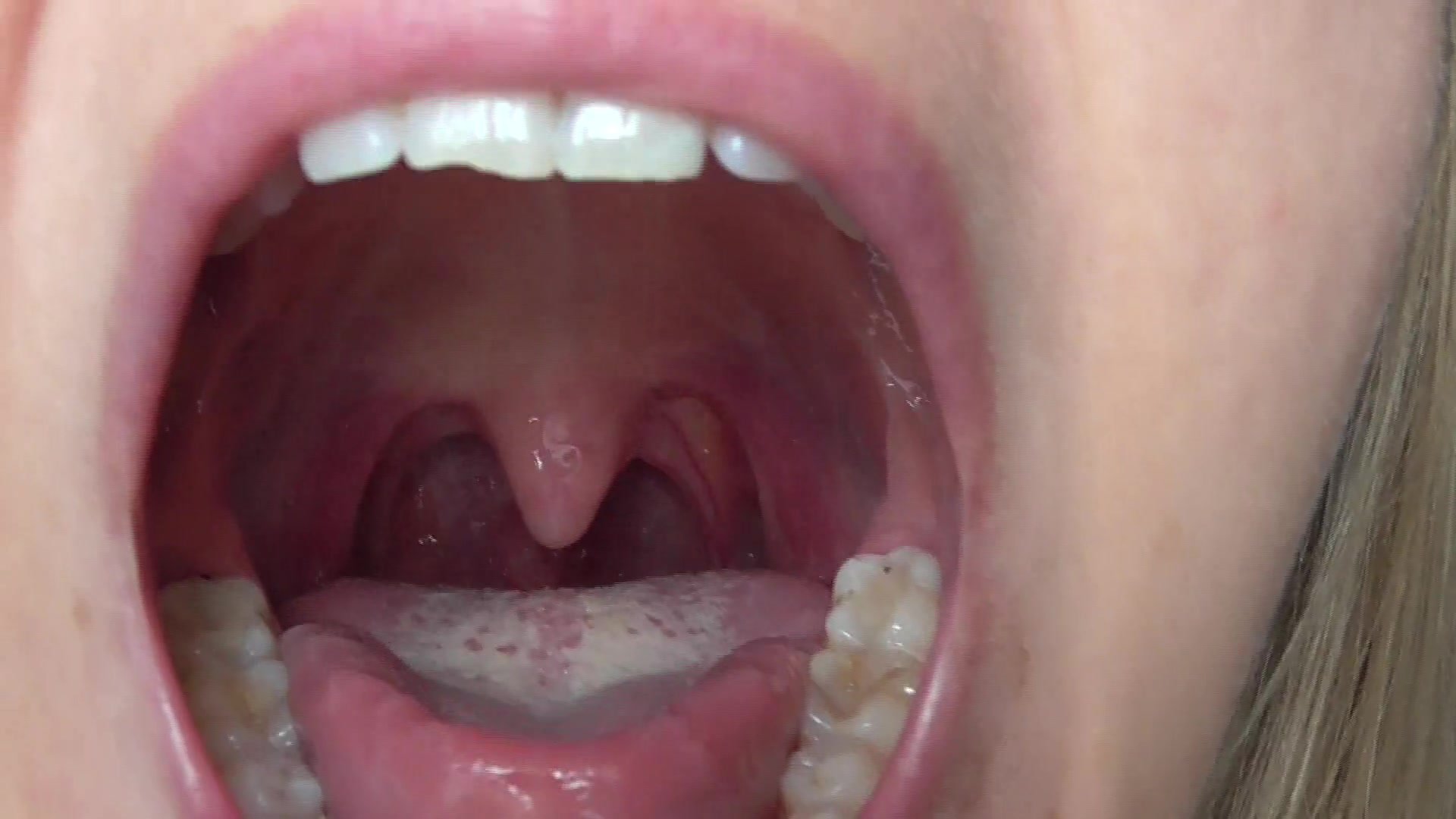 mouth and uvula