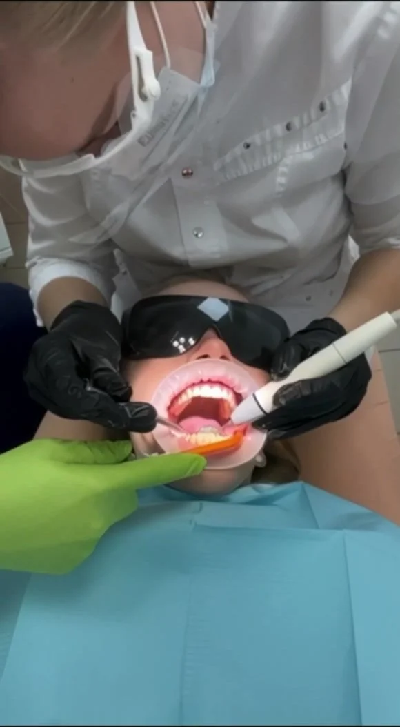 Dental Fetish Porn - Professional teeth scaling dental fetish - ThisVid.com