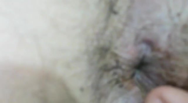 Anus wide spread
