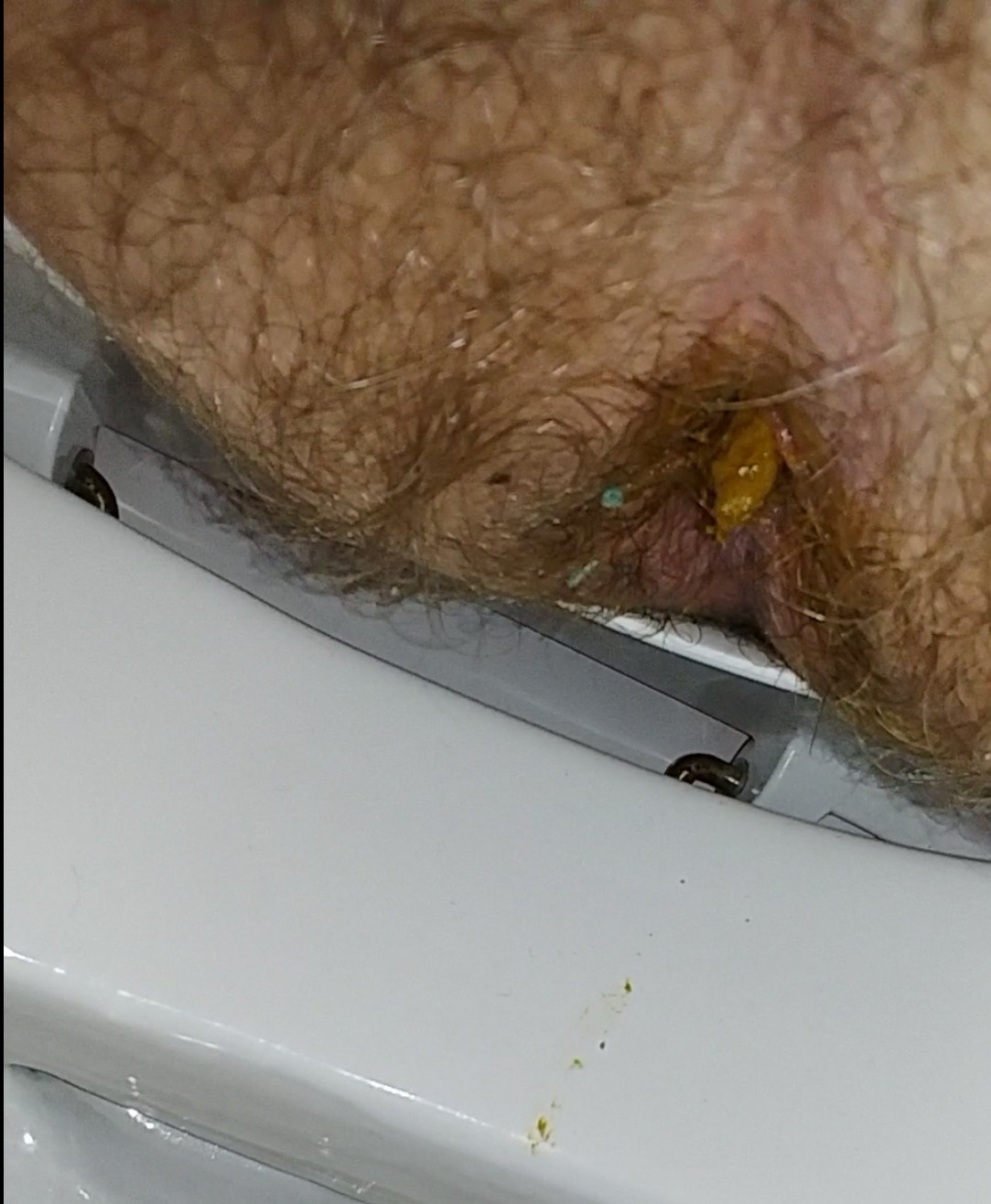 Big shit from my hairy ass