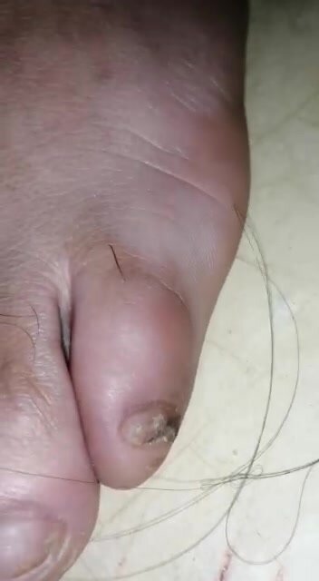 Ugly feet close up