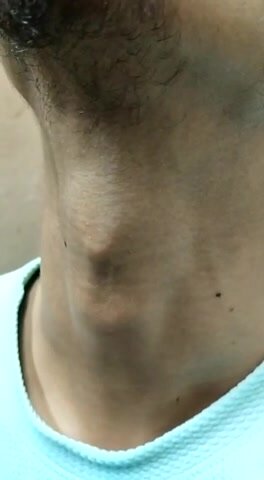 Adams apple - video 66
