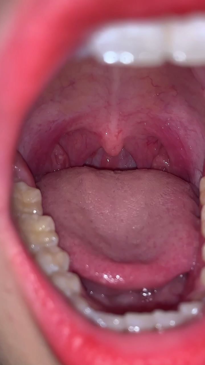 Girl’s mouth - video 2