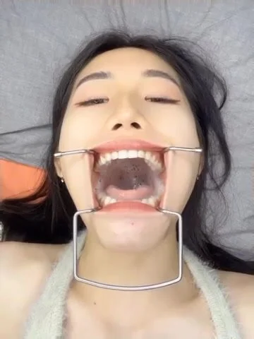 Gagging Swallow - Gagging: girl w/ mouth gag swallowing - ThisVid.com