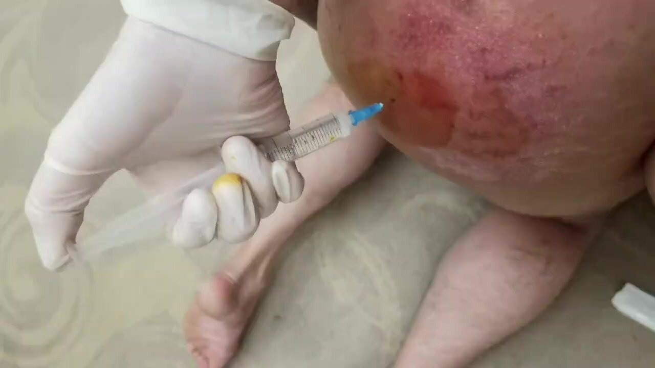 Chinese femdom injection - ThisVid.com