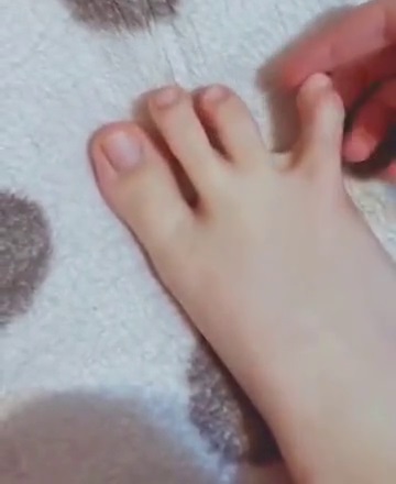 Foot with four toes