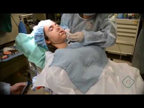 Anesthesia for an oral procedure