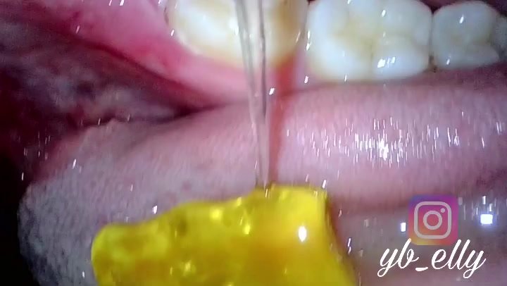 Inside Mouth Gummy Vore
