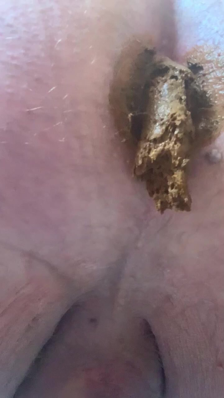 Dimpled ass squirts massive shit