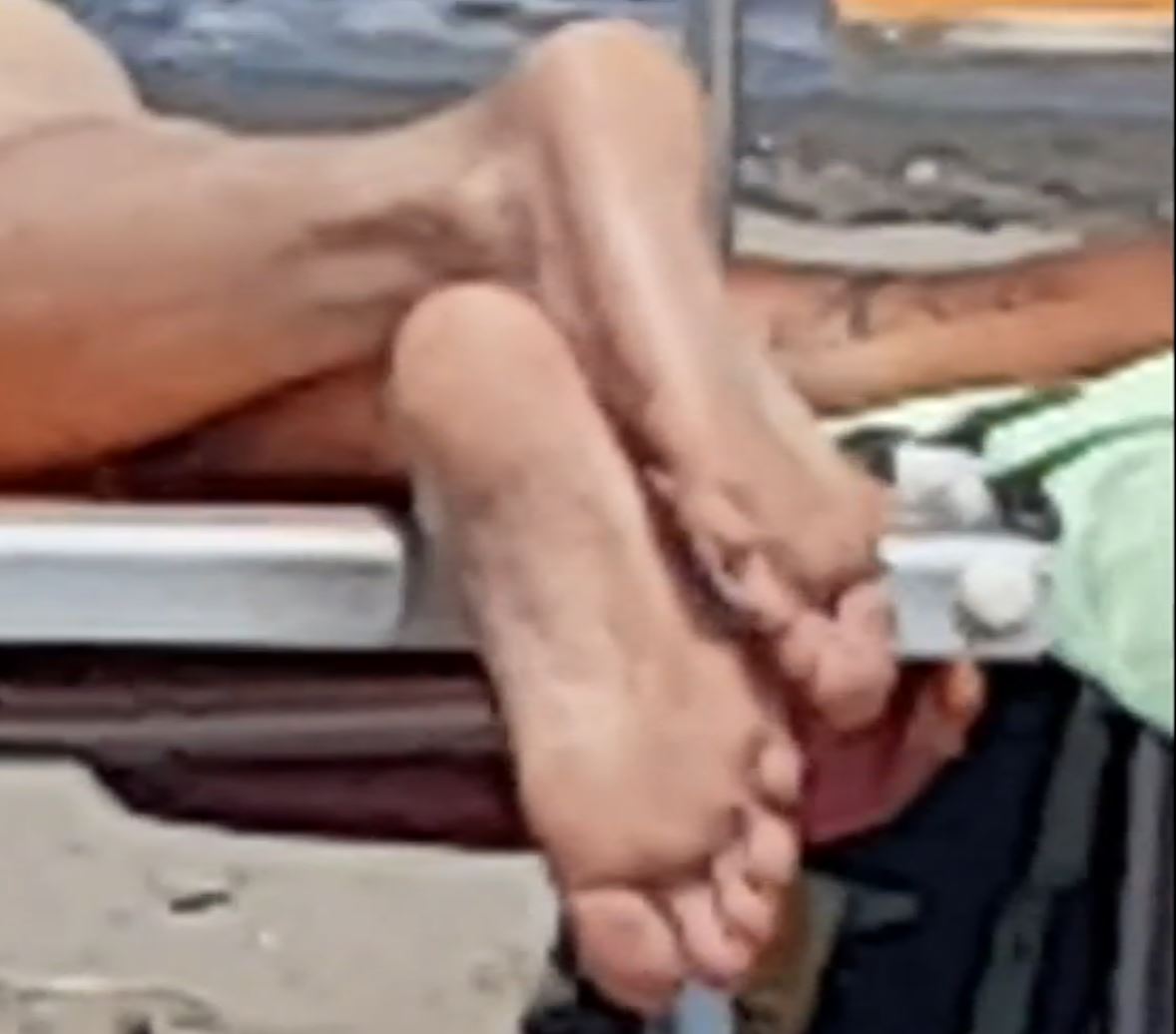 Another soles exposed on the beach