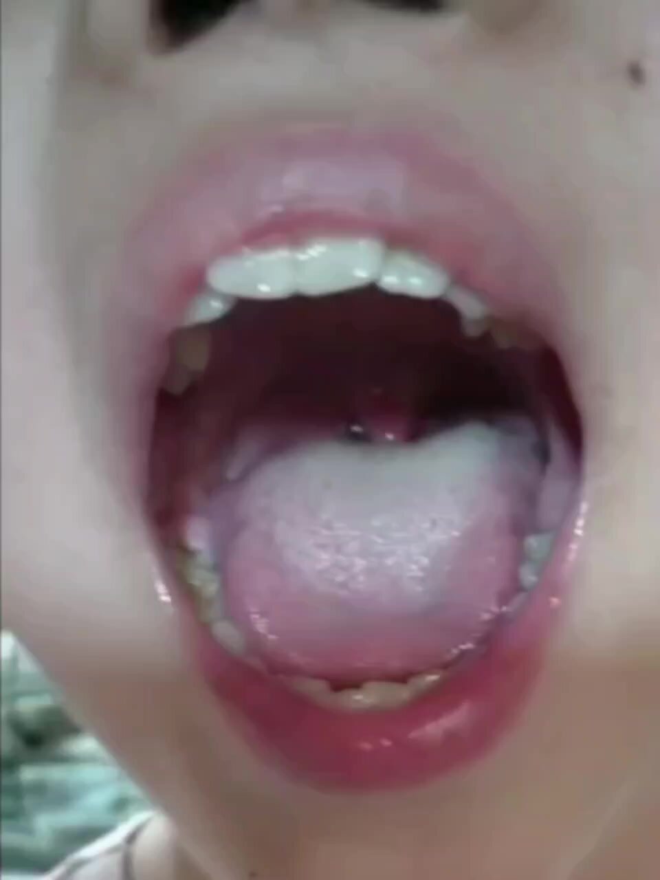 Girl uvula check