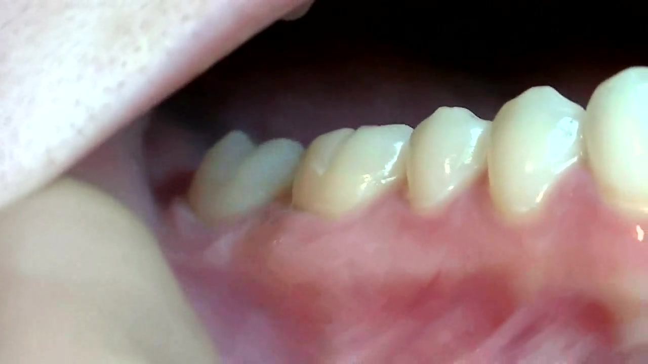 girl shows teeth close up