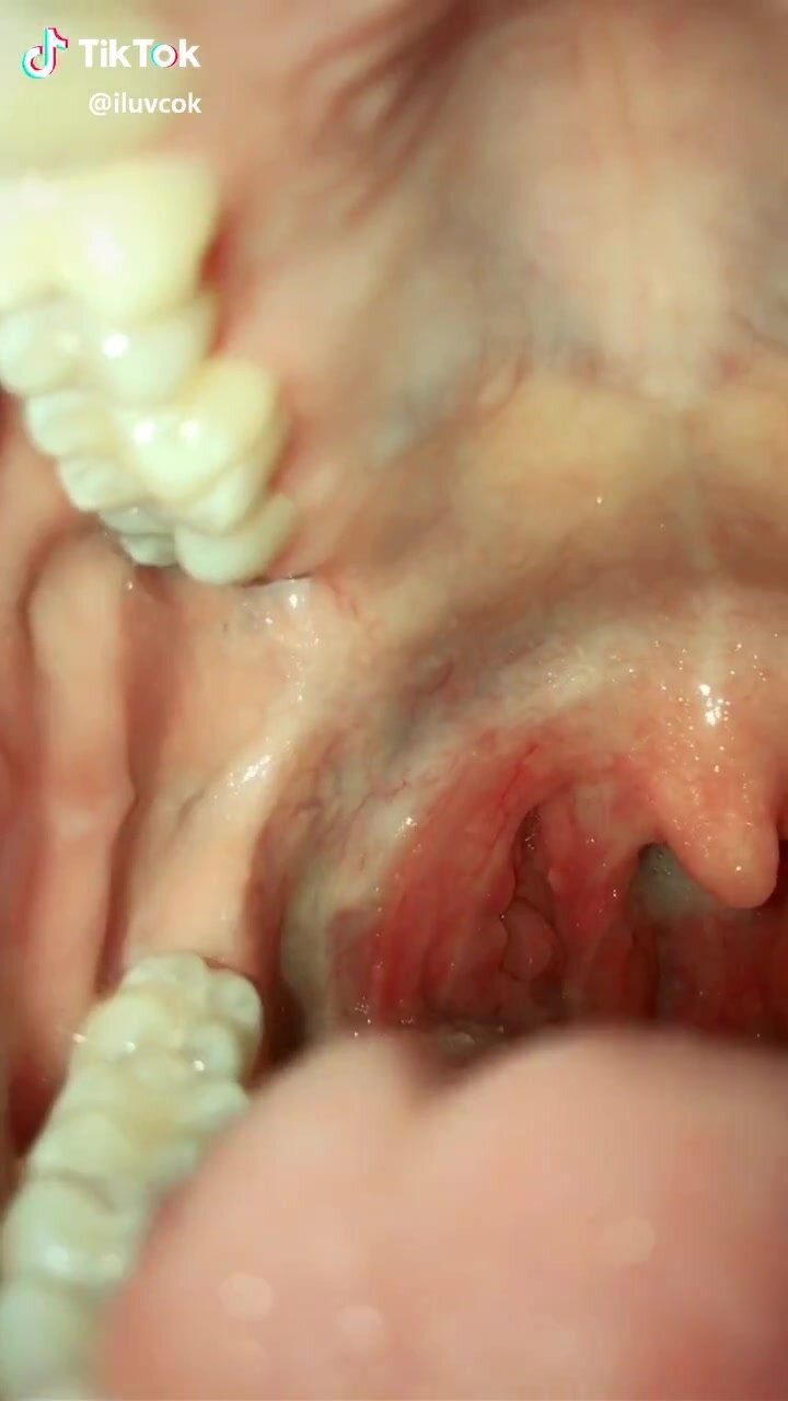 Her Tonsils
