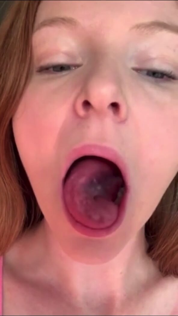 RED HEAD VORE TONGUE UVULA MOUTH THROAT