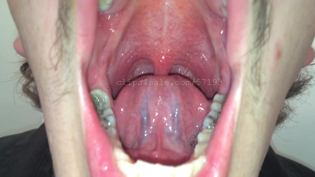 excellent puking/mouth