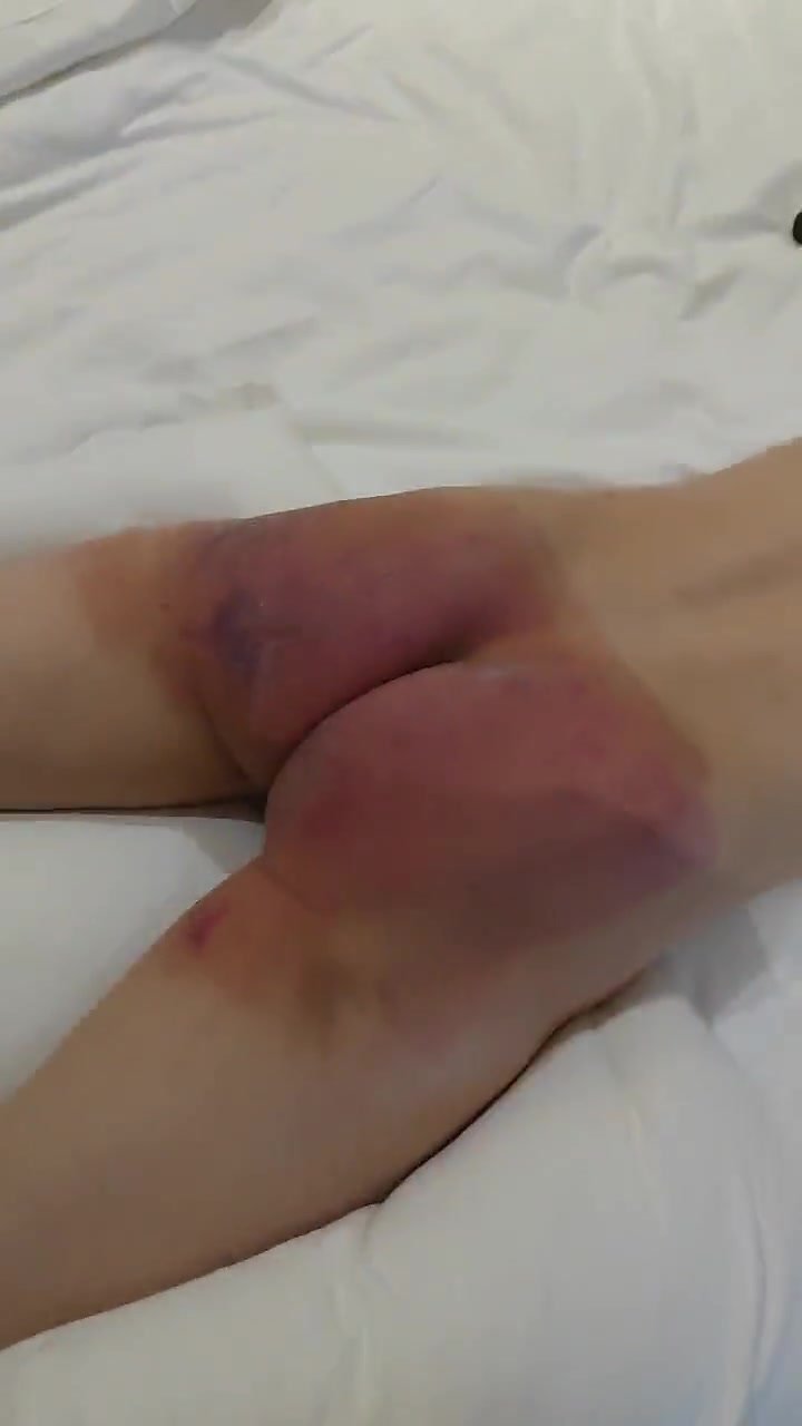 Bruised butt takes more brutal spanking with a strap